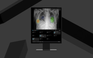 루닛 CXR4, 유럽 CE MDR 인증 획득